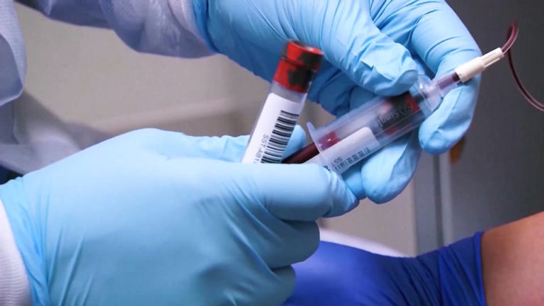 La OMS advierte que uno de cada diez sobrevivientes de la COVID-19 sufren síntomas persistentes y debilitantes