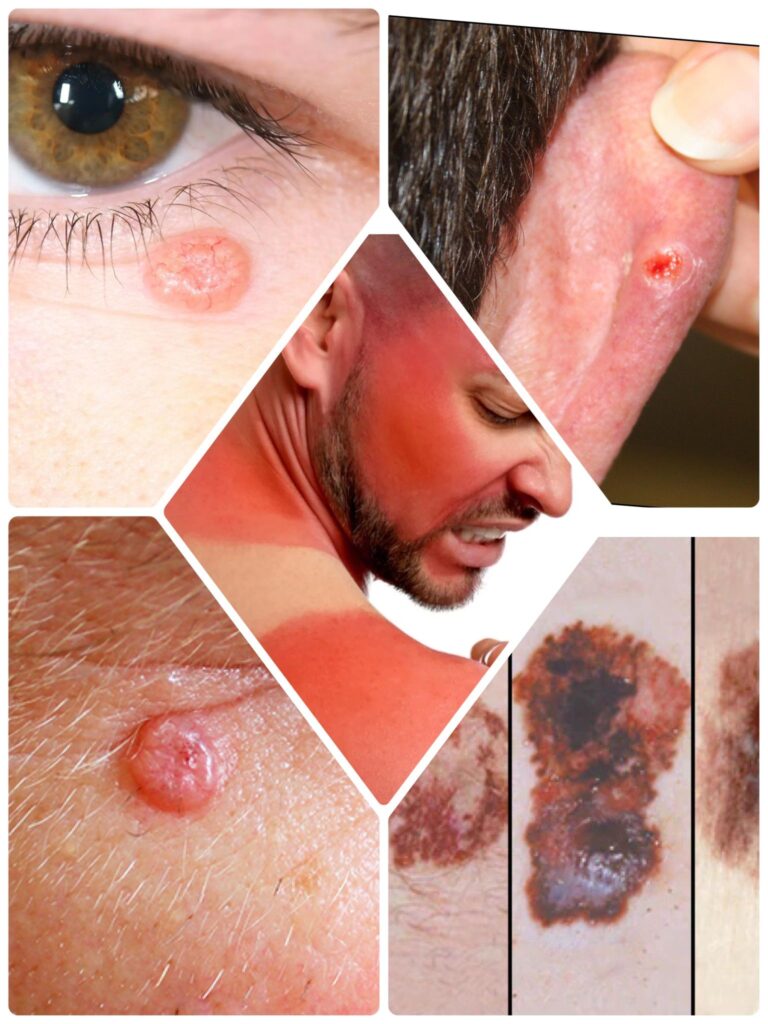 Bloqueadores o protectores solares