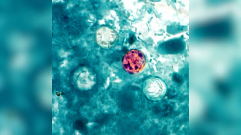 Un brote de ciclosporiasis afecta a miles de personas en EE.UU.
